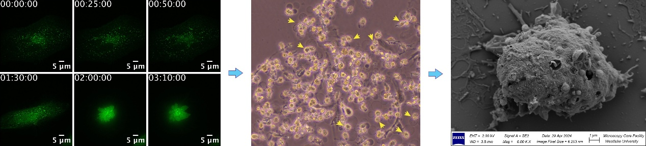 A novel channel protein mediates inflammatory cell death in brain